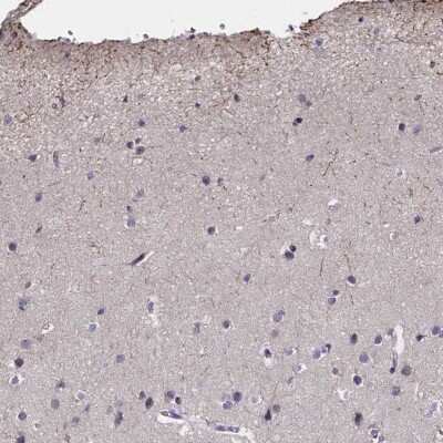 Immunohistochemistry-Paraffin: CACNG8 Antibody [NBP1-86228]