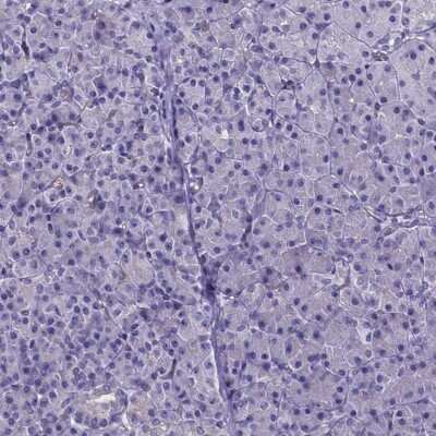 Immunohistochemistry-Paraffin: CACNG8 Antibody [NBP1-86228]