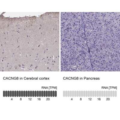 Immunohistochemistry-Paraffin: CACNG8 Antibody [NBP1-86228]