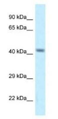 Western Blot: CACNG8 Antibody [NBP1-82391]