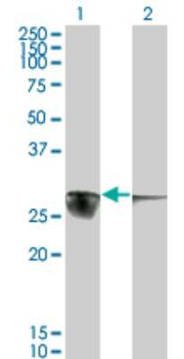 Western Blot: CACYBP Antibody (2E3) [H00027101-M01]