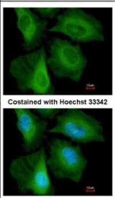 Immunocytochemistry/ Immunofluorescence: CACYBP Antibody [NBP2-15660]