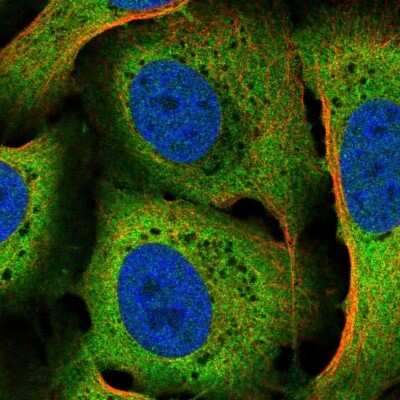 Immunocytochemistry/ Immunofluorescence: CACYBP Antibody [NBP2-55091]