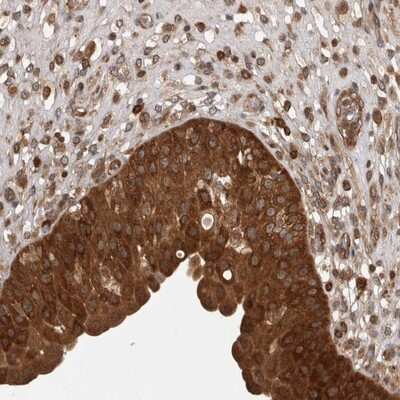 Immunohistochemistry-Paraffin: CACYBP Antibody [NBP1-87104]