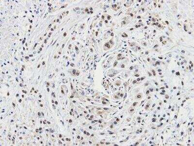 Immunohistochemistry-Paraffin: CACYBP Antibody [NBP2-15660]