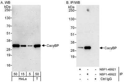 Western Blot: CACYBP Antibody [NBP1-49921]