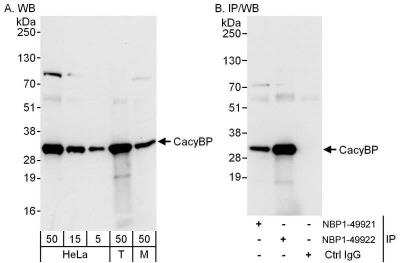 Western Blot: CACYBP Antibody [NBP1-49922]