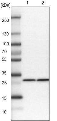 Western Blot: CACYBP Antibody [NBP1-87104]