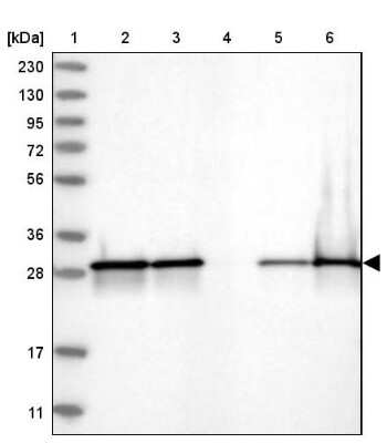 Western Blot: CACYBP Antibody [NBP1-87104]