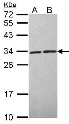 Western Blot: CACYBP Antibody [NBP2-15660]