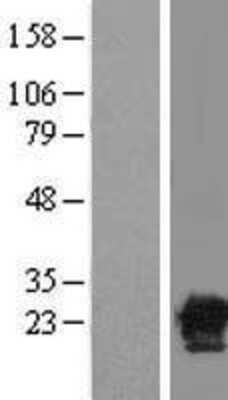 Western Blot: CACYBP Overexpression Lysate [NBL1-08636]