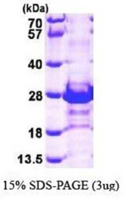 SDS-PAGE: Recombinant Human CACYBP His Protein [NBP1-44443]