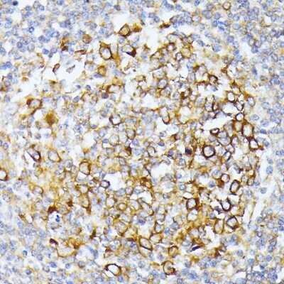 Immunohistochemistry-Paraffin: CAD Antibody - BSA Free [NBP2-92924]