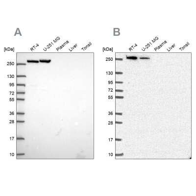 Western Blot: CAD Antibody [NBP2-56453]