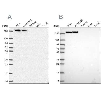 Western Blot: CAD Antibody [NBP2-58494]