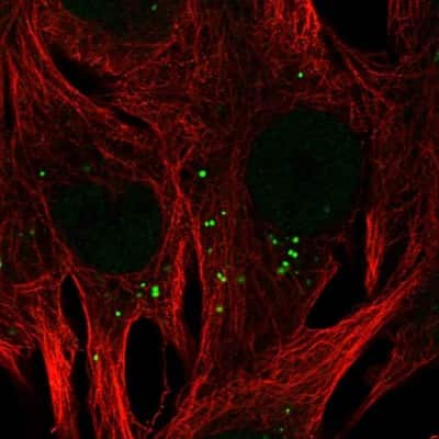 Immunocytochemistry/ Immunofluorescence: CADPS Antibody [NBP2-38871]