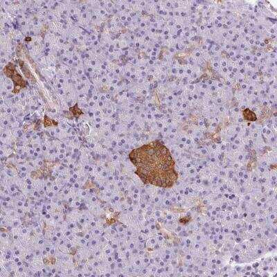 Immunohistochemistry-Paraffin: CADPS Antibody [NBP2-38871]