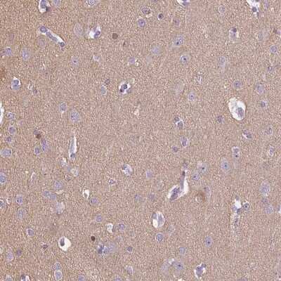 Immunohistochemistry-Paraffin: CADPS Antibody [NBP2-38871]