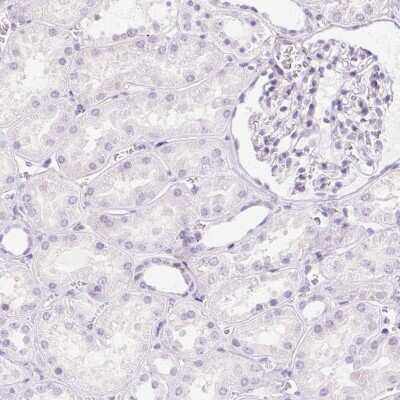 Immunohistochemistry-Paraffin: CADPS Antibody [NBP2-38871]