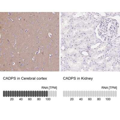 Immunohistochemistry-Paraffin: CADPS Antibody [NBP2-38871]
