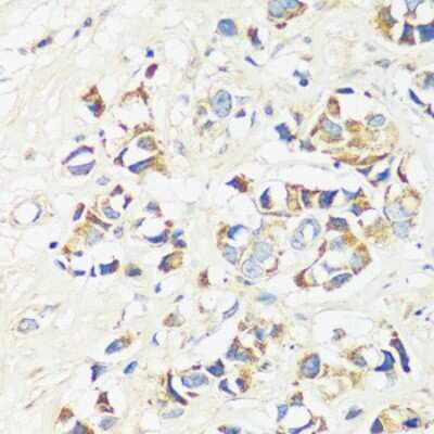 Immunohistochemistry-Paraffin: CADPS Antibody - Azide and BSA Free [NBP3-04378]