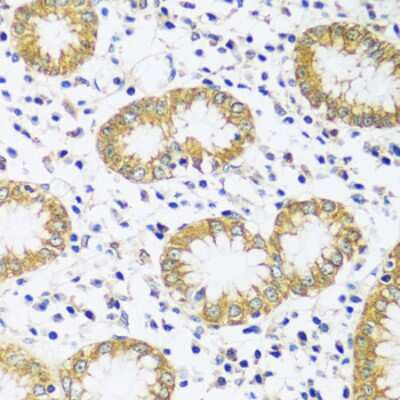 Immunohistochemistry-Paraffin: CADPS Antibody - Azide and BSA Free [NBP3-04378]
