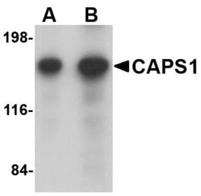 Western Blot: CADPS AntibodyBSA Free [NBP1-77324]