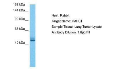 Western Blot: CADPS Antibody [NBP2-87115]