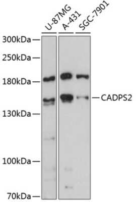 Western Blot: CADPS2 AntibodyAzide and BSA Free [NBP2-92130]