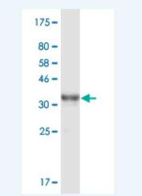 Western Blot: CAIN Antibody (2F5) [H00023523-M02]