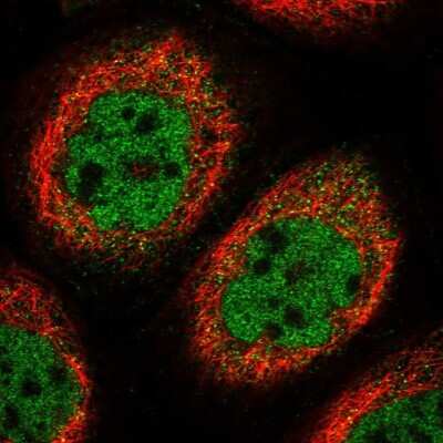 Immunocytochemistry/ Immunofluorescence: CAIN Antibody [NBP1-91745]