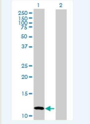 Western Blot: CALCB Antibody [H00000797-B02P-50ug]