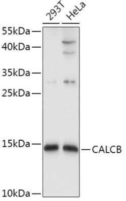 Western Blot: CALCB AntibodyBSA Free [NBP2-92827]