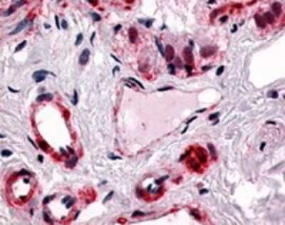 Immunohistochemistry-Paraffin: CRLR Antibody - BSA Free [NLS6731]