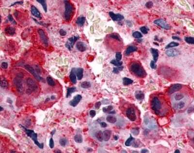 Immunohistochemistry-Paraffin: CRLR Antibody - BSA Free [NLS6731]