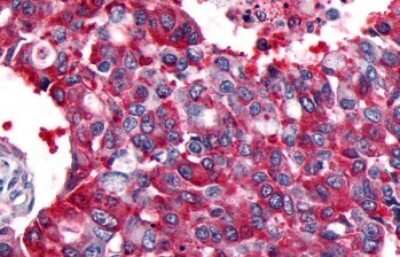 Immunohistochemistry-Paraffin: CRLR Antibody - BSA Free [NLS6731]