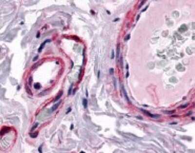 Immunohistochemistry-Paraffin: CRLR Antibody - BSA Free [NLS6755]