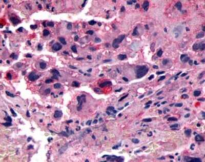 Immunohistochemistry-Paraffin: CRLR Antibody - BSA Free [NLS6755]