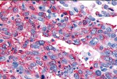 Immunohistochemistry-Paraffin: CRLR Antibody - BSA Free [NLS6755]