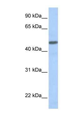 Western Blot: CRLR Antibody [NBP1-59073]