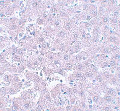 Immunohistochemistry-Paraffin: CALHM1 Antibody - BSA Free [NBP1-77112]