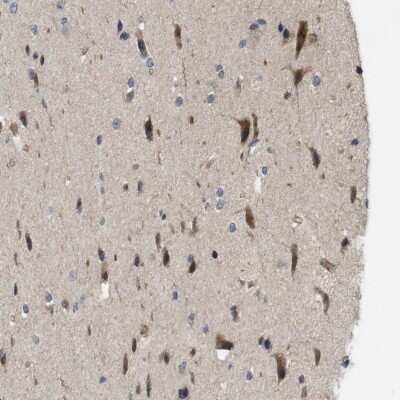 Immunohistochemistry-Paraffin: CALHM1 Antibody [NBP1-83930]