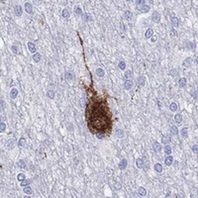 Immunohistochemistry-Paraffin: CALHM1 Antibody [NBP3-17220]