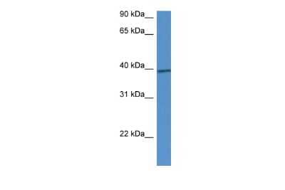 Western Blot: CALHM1 Antibody [NBP2-87116]