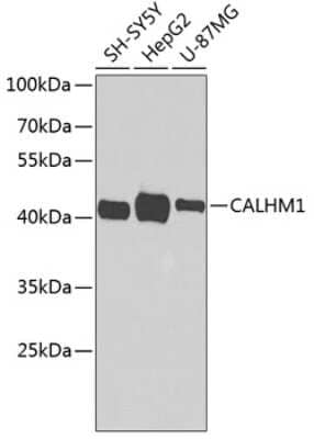 Western Blot: CALHM1 AntibodyBSA Free [NBP2-92818]