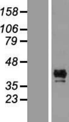 Western Blot: CALHM1 Overexpression Lysate [NBP2-08979]