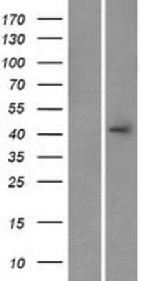 Western Blot: CALHM3 Overexpression Lysate [NBP2-09492]