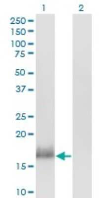 Western Blot: CALML3 Antibody (2A11) [H00000810-M04]