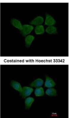 Immunocytochemistry/ Immunofluorescence: CALML3 Antibody [NBP2-15667]