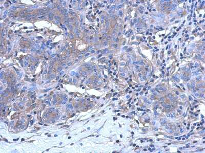 Immunohistochemistry-Paraffin: CALML3 Antibody [NBP2-15667]
